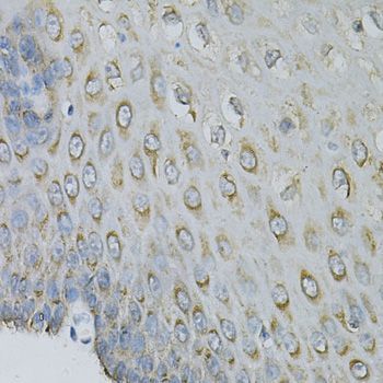Immunohistochemistry - EIF4B Polyclonal Antibody (144-05405)
