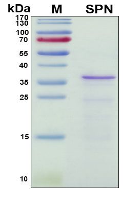 SDS-PAGE