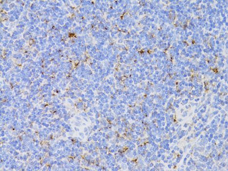 Immunohistochemistry - CD3E antibody (144-012415)