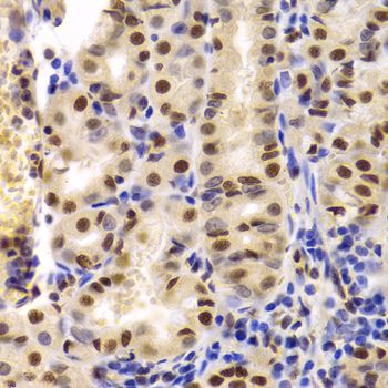 Immunohistochemistry - XRCC5 Antibody (144-05862)