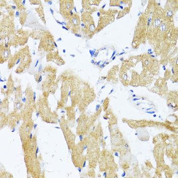 Immunohistochemistry - SLC2A4 antibody (144-07637)