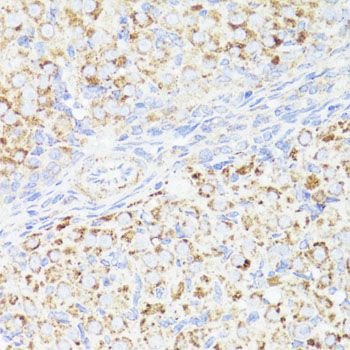 Immunohistochemistry - [KO Validated] ErbB2 Polyclonal Antibody (144-02071)