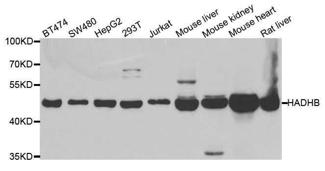 Western blot - HADHB antibody (144-05716)