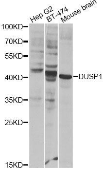 Western blot - DUSP1 Antibody (144-02919)