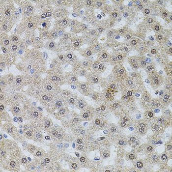 Immunohistochemistry - POP4 antibody (144-04452)