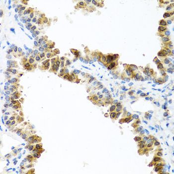 Immunohistochemistry - ACVR1C Polyclonal Antibody (144-00678)