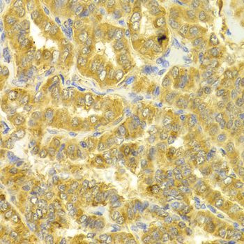 Immunohistochemistry - DLD Antibody (144-05403)