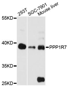Western blot - PPP1R7 antibody (144-60156)