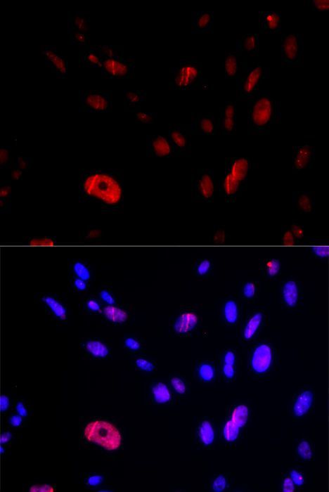 Immunofluorescence - HUS1 Polyclonal Antibody (144-05407)