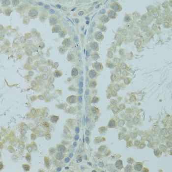 Immunohistochemistry - HUS1B Polyclonal Antibody (144-60739)