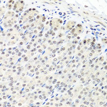 Immunohistochemistry - CNOT8 antibody (144-08058)