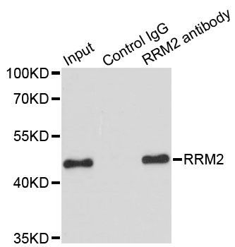 Immunohistochemistry - RRM2 Polyclonal Antibody (144-05255)