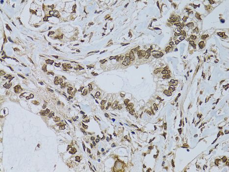 Immunohistochemistry - EMD Polyclonal Antibody (144-60520)