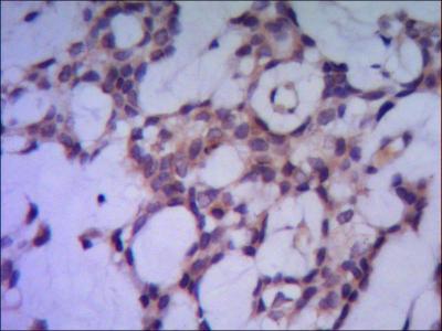 IHC