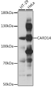 Western blot