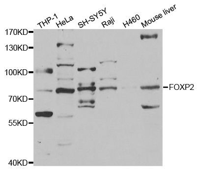 Western blot - FOXP2 antibody (144-05677)
