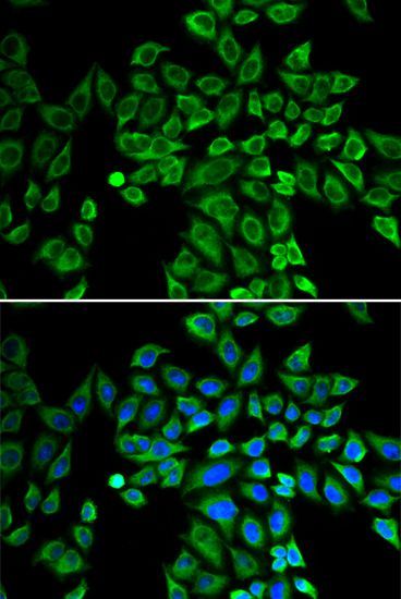 Immunofluorescence - ANGPT2 Polyclonal Antibody (144-00698)