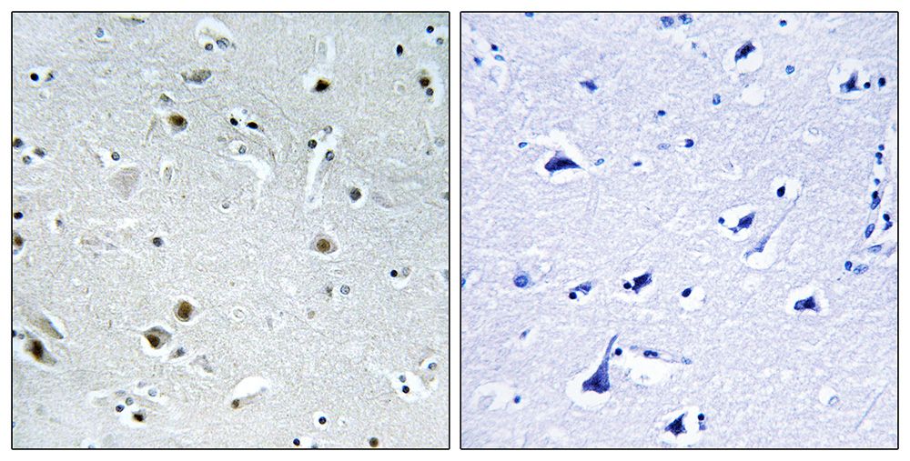 IHC