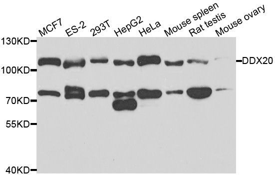 Western blot - DDX20 antibody (144-05817)
