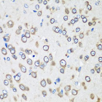 Immunohistochemistry - EEF1G antibody (144-07891)