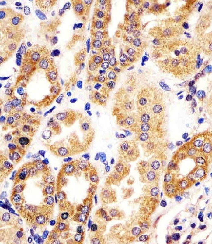 IHC-P