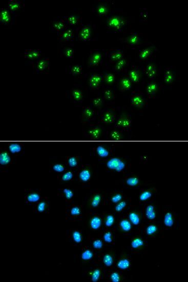 Immunofluorescence - EIF6 antibody (144-01818)
