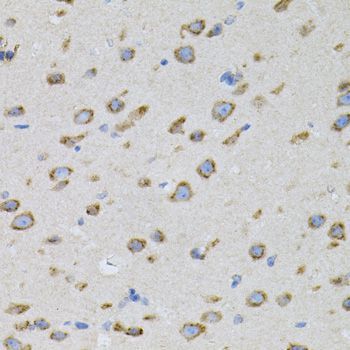 Immunohistochemistry - NAPA antibody (144-07946)