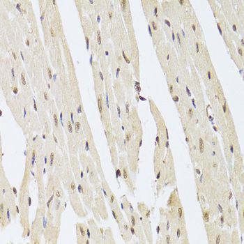 Immunohistochemistry - AAAS Antibody (144-06427)