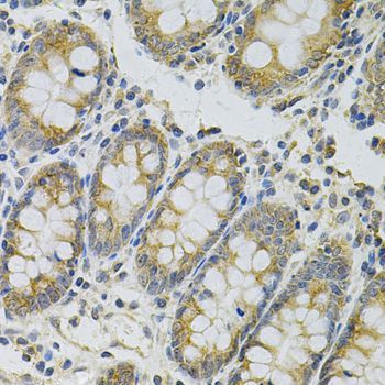 Immunohistochemistry - MYD88 Polyclonal Antibody (144-60032)