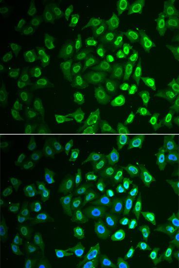 Immunofluorescence - FAH antibody (144-06586)