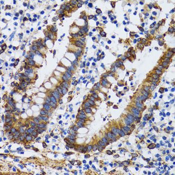 Immunohistochemistry - PGRMC1 antibody (144-05619)