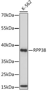Western blot