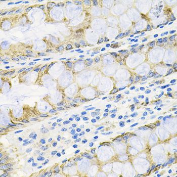 Immunohistochemistry - ACVR2A Polyclonal Antibody (144-01981)