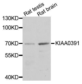 Western blot - KIA144-00391 antibody (144-03360)