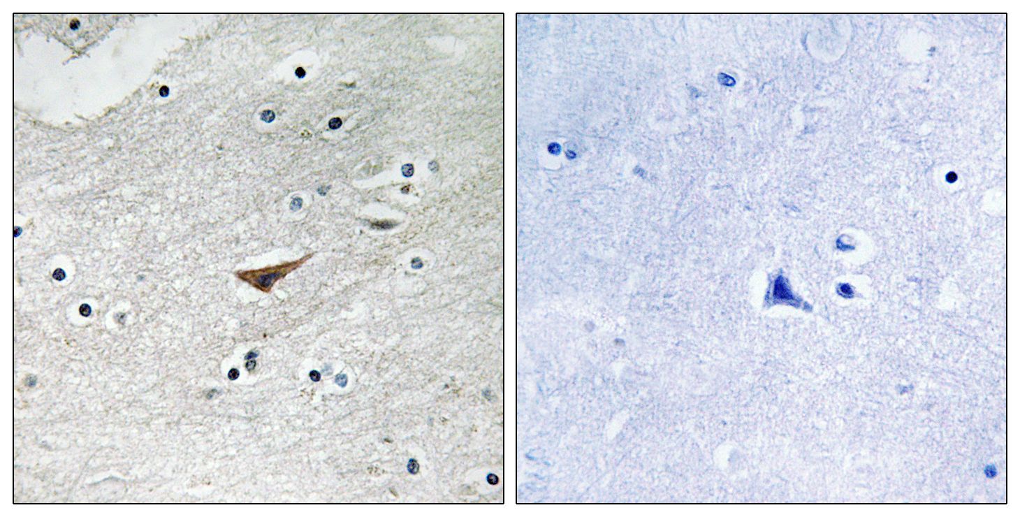 IHC