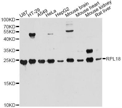 Western blot - RPL18 Polyclonal Antibody (144-10720)