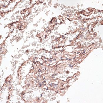 Immunohistochemistry - COL6A1 antibody (144-09236)