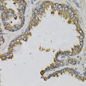 Immunohistochemistry - EFNA1 Polyclonal Antibody (144-05341)