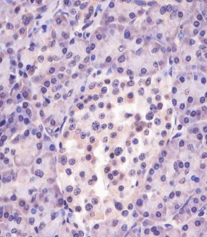 IHC-P