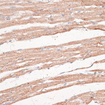 Immunohistochemistry - KDM8 antibody (144-011606)