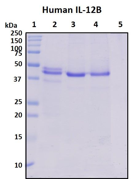 SDS-PAGE