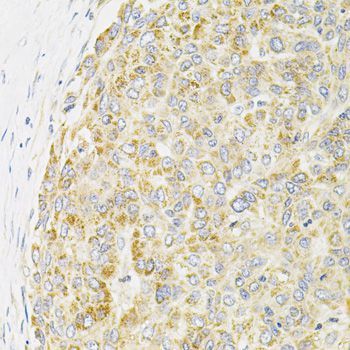 Immunohistochemistry - PPP1CA Polyclonal Antibody (144-12468)