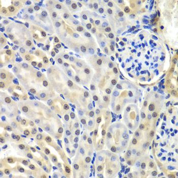 Immunohistochemistry - SNRPD2 Polyclonal Antibody (144-06983)