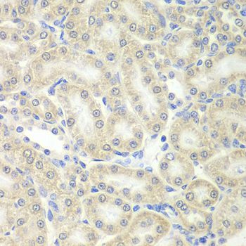 Immunohistochemistry - PRDX5 Polyclonal Antibody (144-06329)