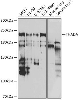 Western blot