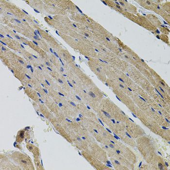 Immunohistochemistry - ALDH9A1 Polyclonal Antibody (144-07875)