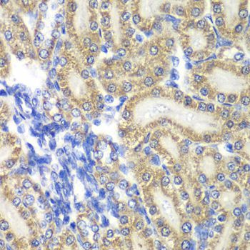 Immunohistochemistry - PTGES2 Polyclonal Antibody (144-07137)