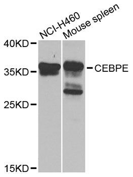 Western blot - CEBPE antibody (144-08047)