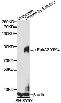 Western blot - Phospho-EphA2-Y594 pAb (144-61534)