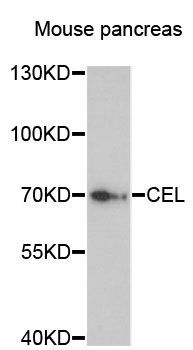 Western blot - CEL antibody (144-013011)
